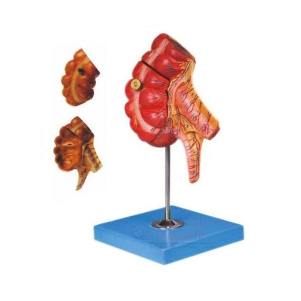 Appendix and Caecum Model