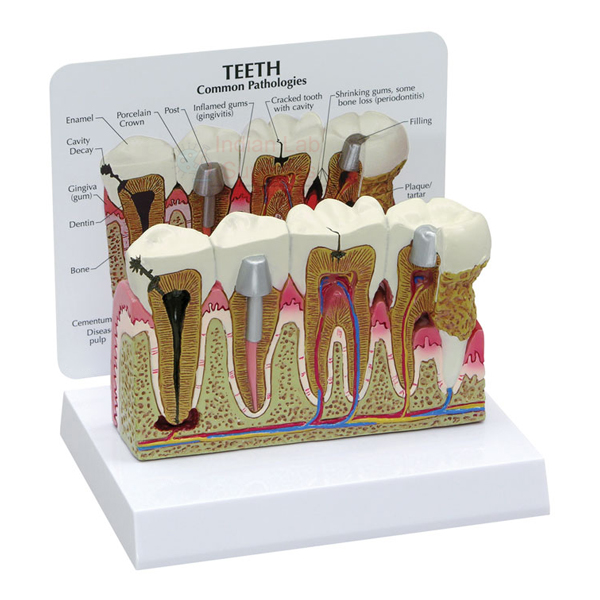 Teeth Model With Description Plate